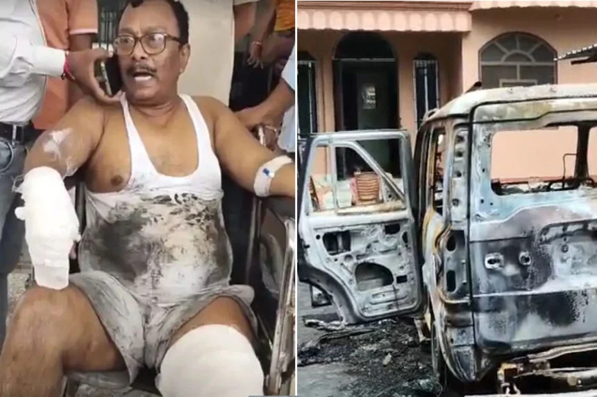 आग, पशुपालन अफसर, झुलसे, सहरसा, स्कॉर्पियो