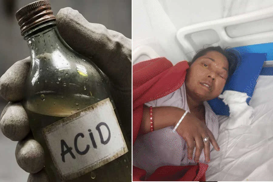 पत्नी, जबरन, पिलाई, तेजाब, पति, खुदकुशी, भागलपुर